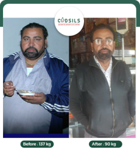 metabolic surgery results